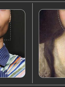 A very personal take on  jawline