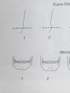 Why  Bone Rugosity Matters